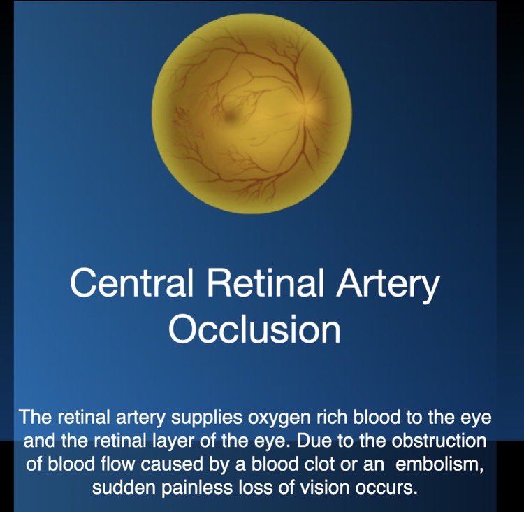 Central Retinal Artery Occlusion