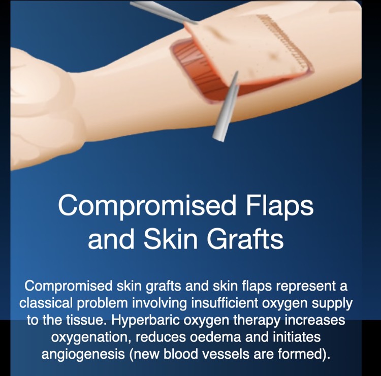 Compromised Flap and Skin Grafts