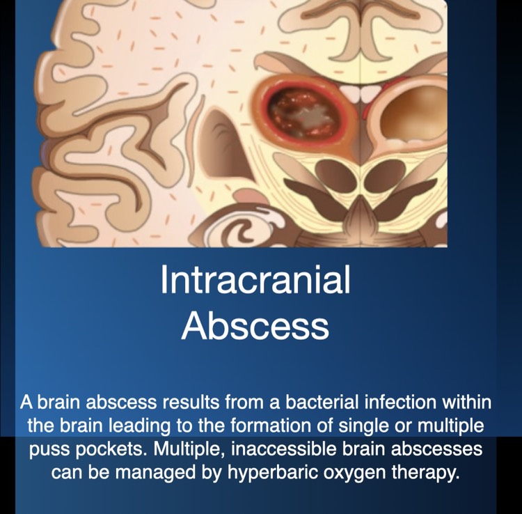 Intracranial Abscess